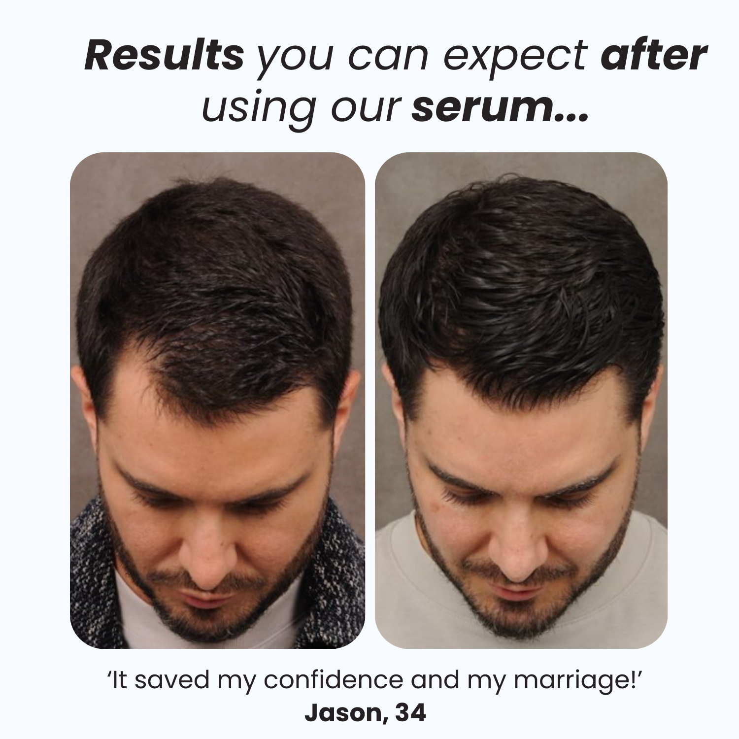 Hair Loss Reversal Serum