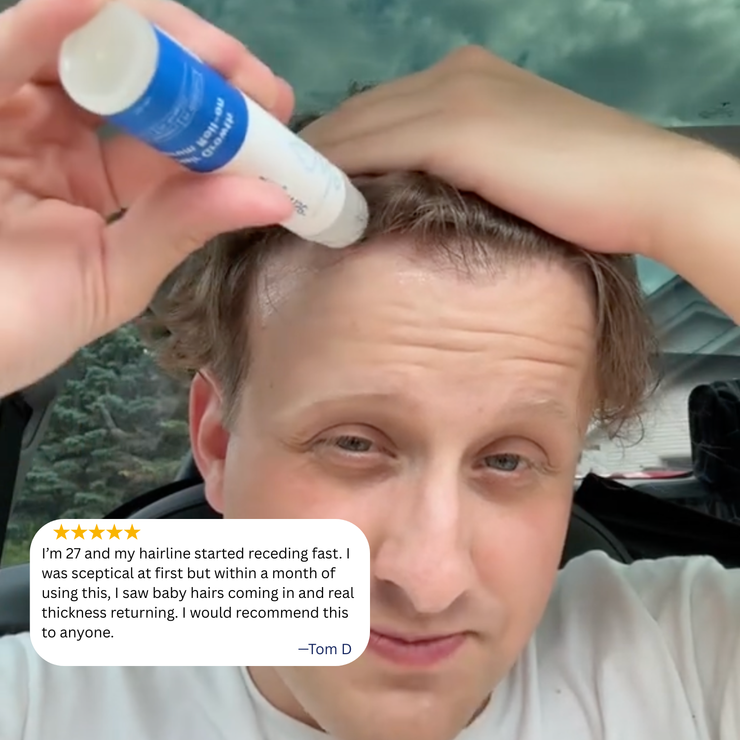 Hair Loss Reversal Serum
